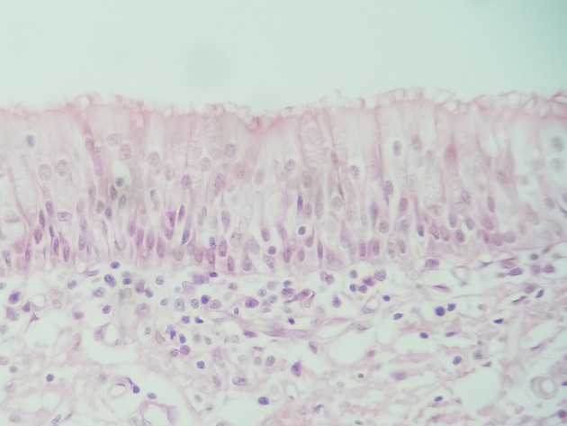 Pseudostratified Epithelium Slides - Pseudostratified Epithelium 16 400X